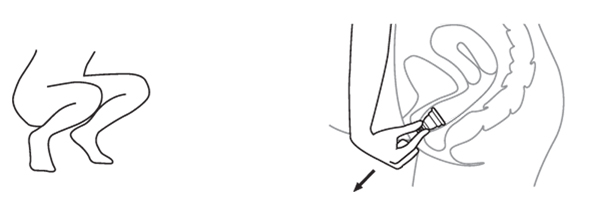 menstruační kalíšek